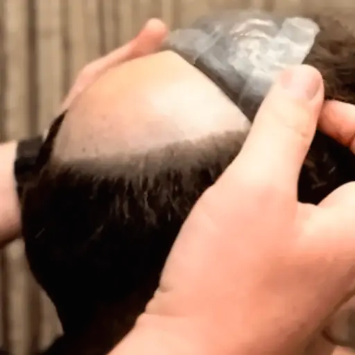 Manutenção protese